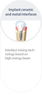 임플란트 세라믹 / 금속 인터페이스 - 고에너지빔기반 인터페이스 믹싱기술